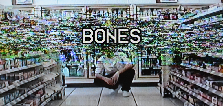 Bones